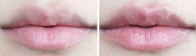 niod-lip-bio-lipid-plumper-before-after